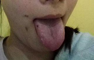 吃花纹瓜舌头疼,探寻舌尖上的头痛之谜